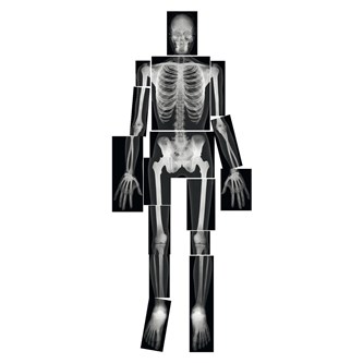 Röntgenkuvat ihminen, 18 kpl