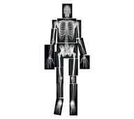 Röntgenkuvat ihminen, 18 kpl